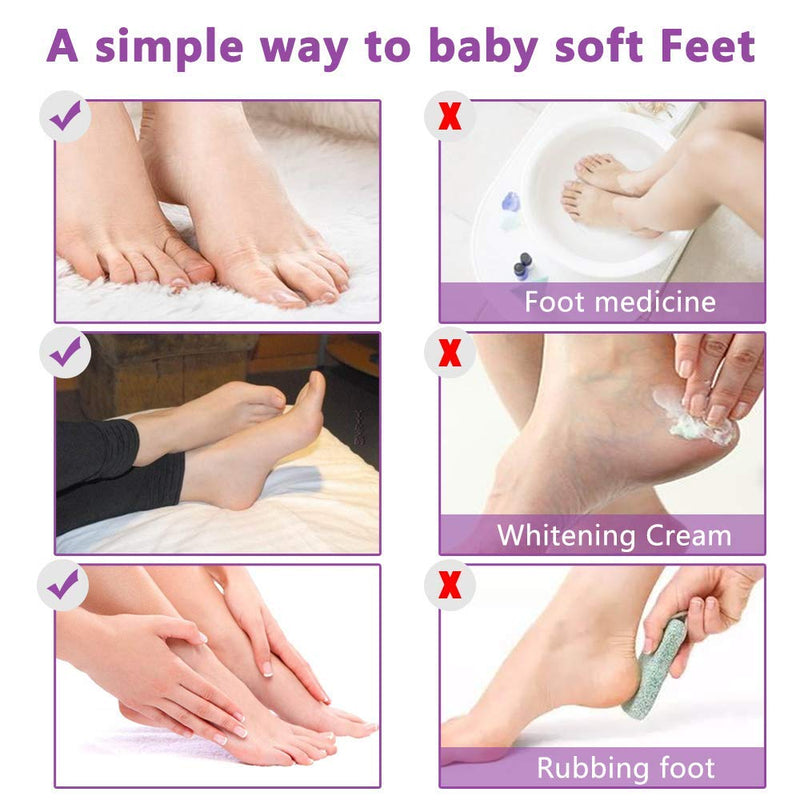 Foot Peel Mask -5 pack, Exfoliate Dead Skin & Calluses,Cracked Heels,Natural Moisturizing for Rough Heels, Baby Soft Smooth Touch Feet-Men &Women(Lavender) - BeesActive Australia