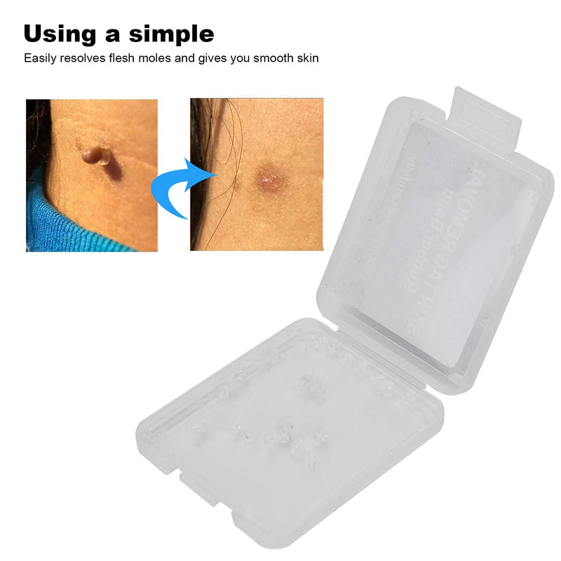 Sonew 30Pcs Skin Tag Band, Non Toxic Safe Micro Skin Tag Removal Rubber Bands Mole Wart Skin Care Tools - BeesActive Australia