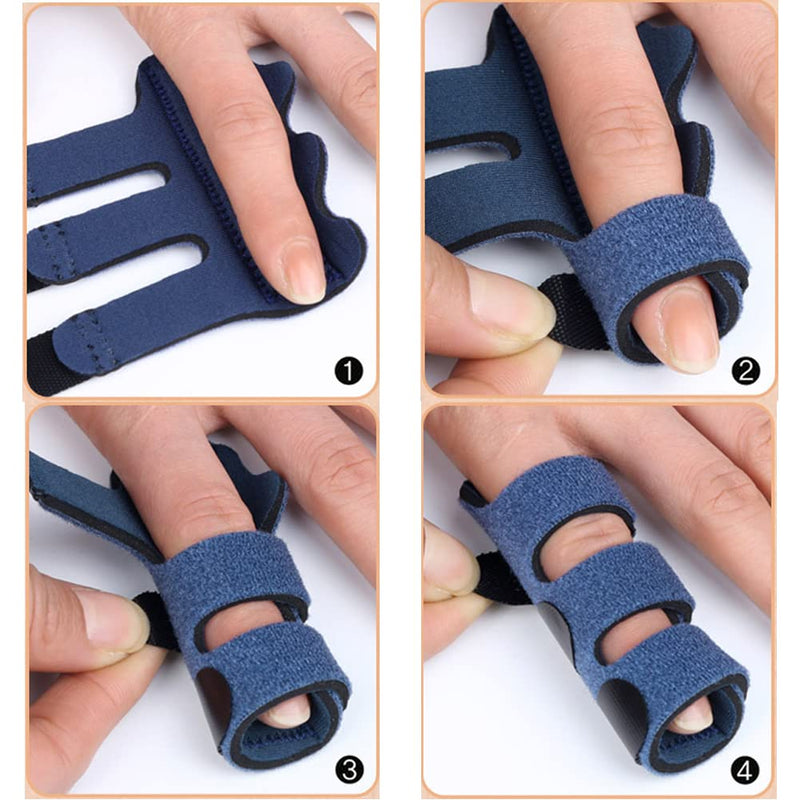 Upgraded Finger Splints (4Pcs), Trigger Finger Splint Finger Brace with 3 Fixing Strap for Mallet Finger, Broken Finger Protector, Knuckle Immobilization, Straightening Support, Arthritis Pain Relief - BeesActive Australia