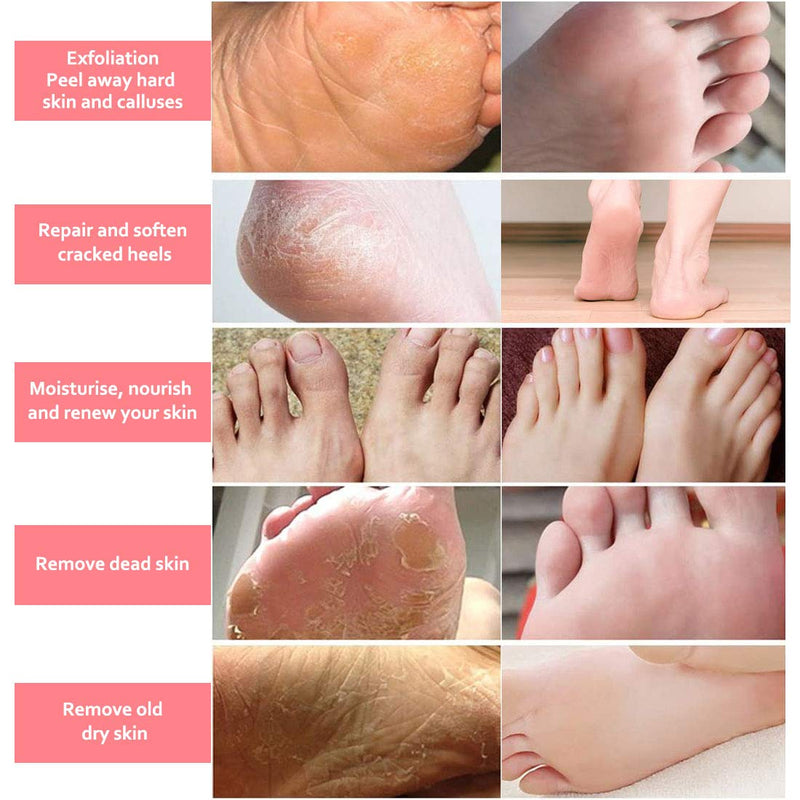 Foot Peel Mask - 5 Pack of Peach Foot Mask - Removes Calluses,Dead and Dry Skin - Repairs Rough Heels, Foot Peeling Mask for Women and Men - BeesActive Australia