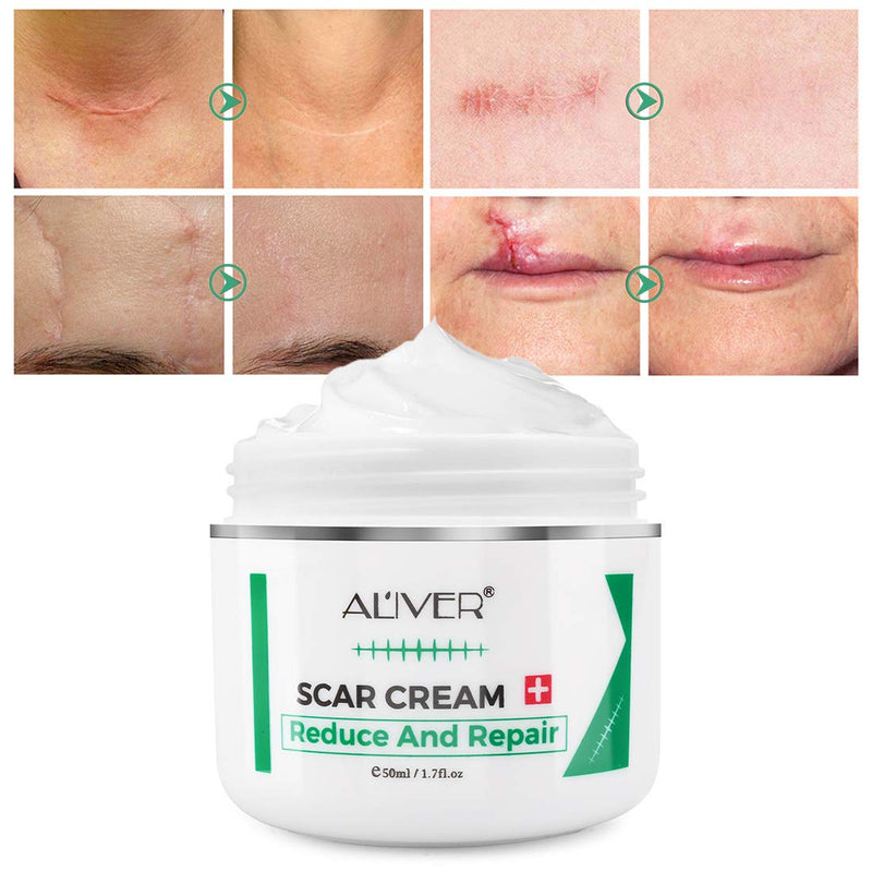 Scar Removal Cream 50G Scar Cream for Old New Scars Stretch Mark Removal Acne Spots and Burns Repair, Face Skin Repair Cream for Men & Women - BeesActive Australia