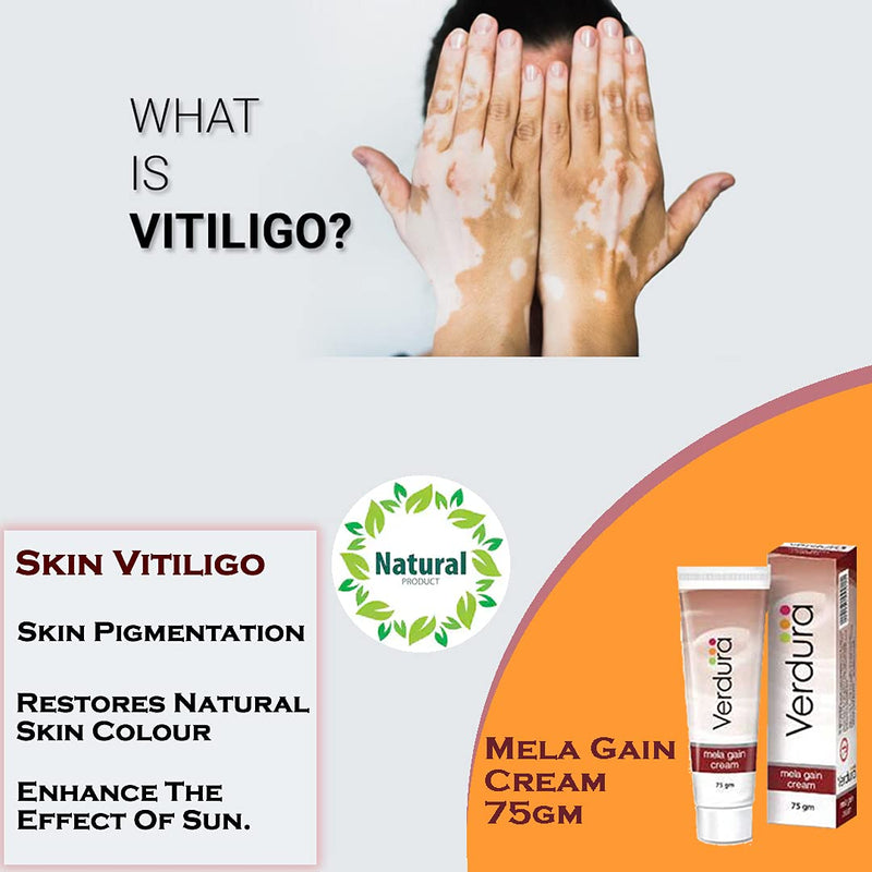Herbal Aid Mela Gain Cream For Vitiligo And Hypo-Pigmentation White Spots Skin Care 75gm Cream Pack of 2 - BeesActive Australia
