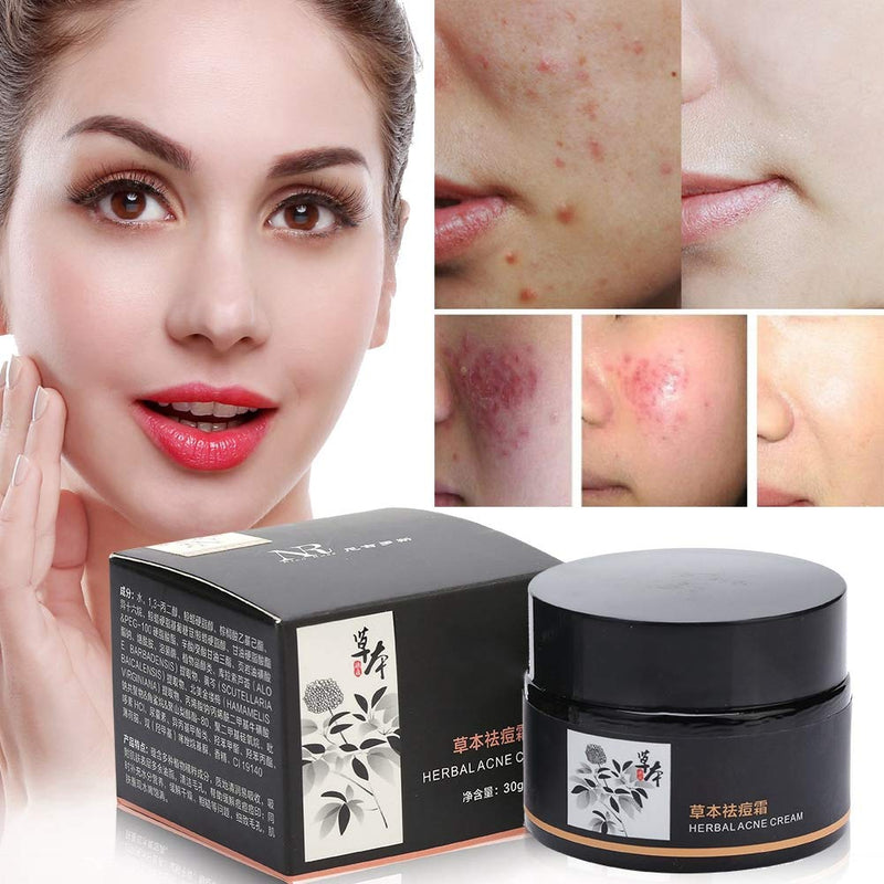 Scar Cream, Acn-es Scar Remover, Acn-es Stretch Mark Scar Removal for Old Scars on Body Face - BeesActive Australia