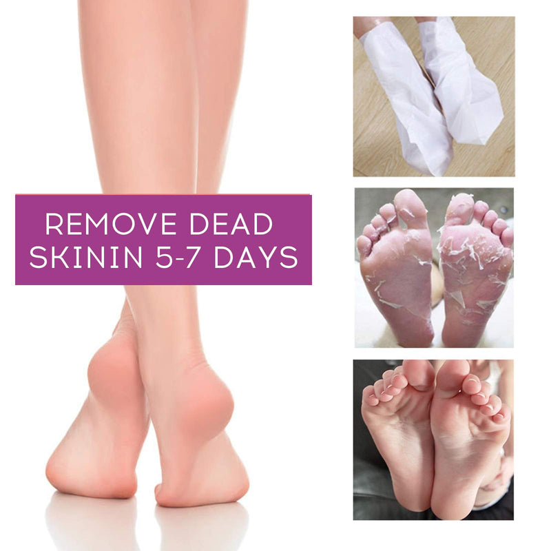 Foot Peel Mask, 3 Pairs Lavender Baby Foot Peel for Dry Cracked Feet, Moisturizing Exfoliating Socks 3 in 1 Foot Care for Dry, Aging, Dead Skin Remover for Feet - BeesActive Australia