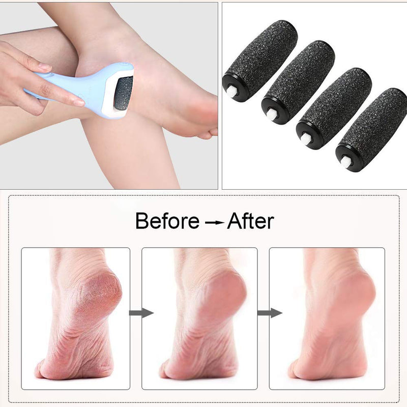 Callus Remover Replacement Refill Heads - Foot File Roller Heads Replacement Compatible with Electric Foot Files Easily Remove the Tough, Hard, Cracked, Dry, and Callused Skin (Black) - BeesActive Australia