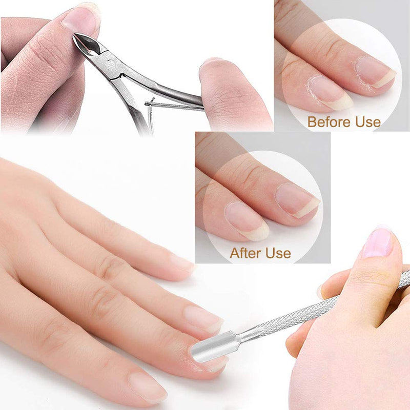 Linkhood Professional Pedicure Tools Set(20 in 1), Foot Care Pedicure Kit Stainless Steel Foot Rasp Foot Dead Skin Remover Pedicure Kit for Men Women Mother’S Day Gift - BeesActive Australia