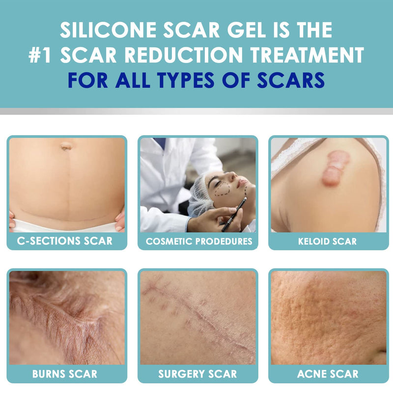 Wewell Medical-Grade Silicone Scar Gel, Advanced Scar Gel for Face Body, Scar Gel Effective for Both Old and New Scars - BeesActive Australia