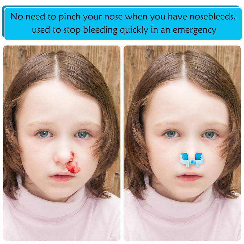 Nose Stop Clips Nasal Nose Stopper Clips Plastic Foam Nose Clips for Emergency or Accident (10) - BeesActive Australia