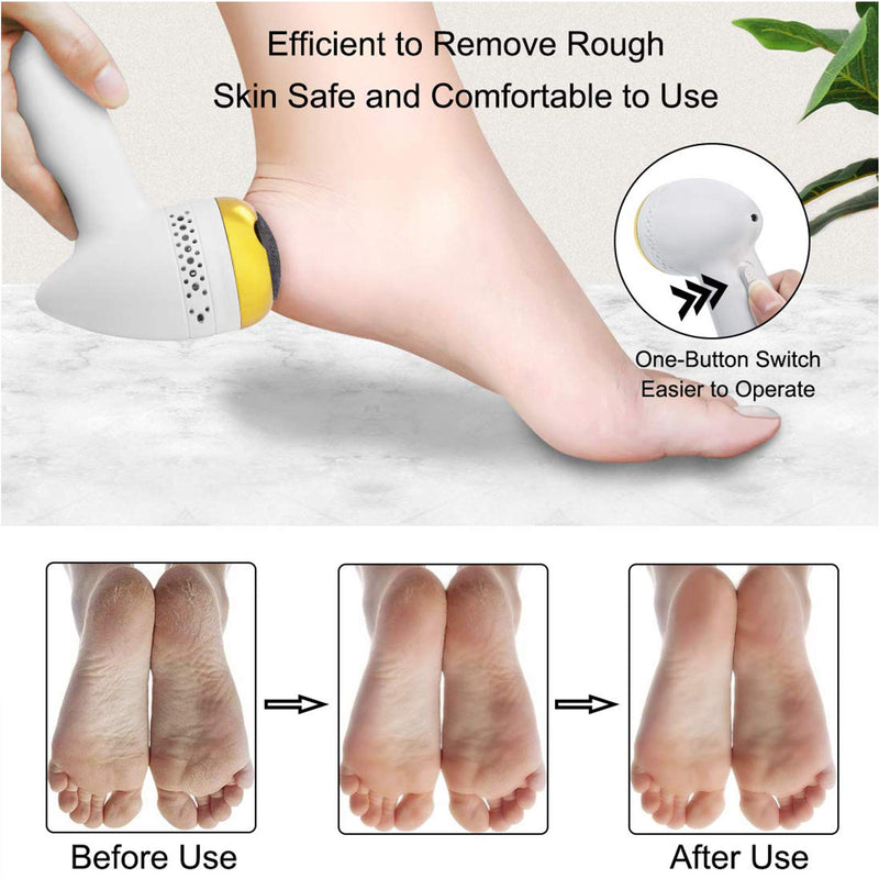 Electric Foot Callus Remover, Electronic Vacuum Adsorption Foot File, Portable Rechargeable Foot Grinder,Pedicure Tool Kit Foot Care for Dead Hard Cracked Dry Skin, Feet Sander Ideal Gift Upgrade - BeesActive Australia