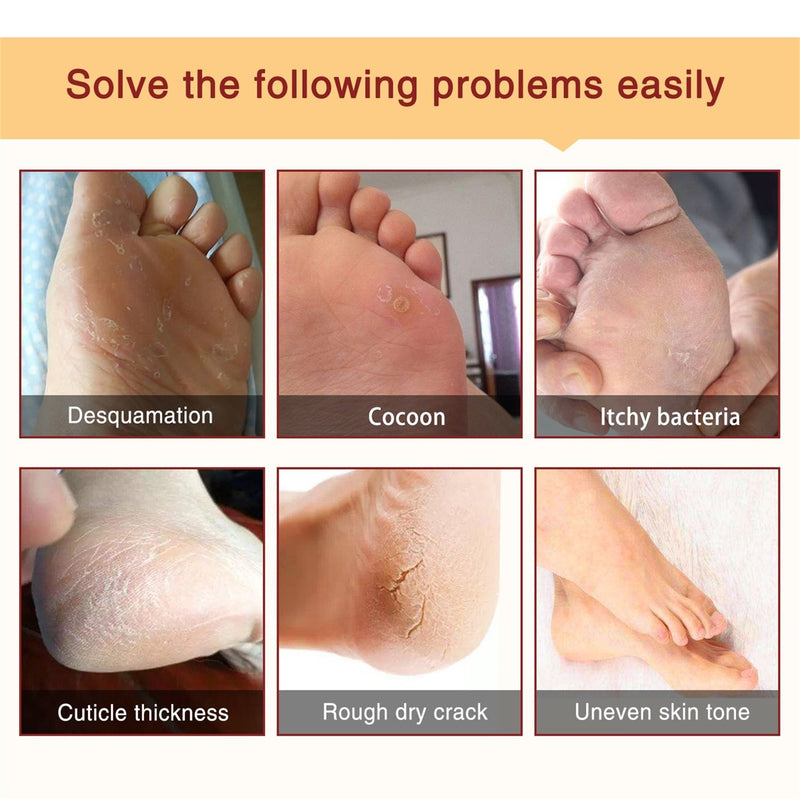 Foot Mask 3 Pack, Exfoliating Foot Peel Mask for Cracked Heels, Dead Skin and Calluses, Repairs Rough Heels(Rose) - BeesActive Australia