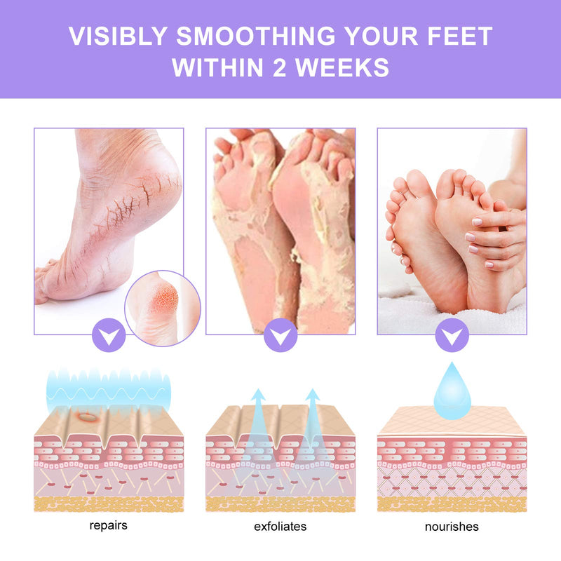 Foot Peel Mask, (3 PACK)Exfoliating Foot Masks,Peeling Away Calluses and Dead Skin Cells, Baby Soft Smooth Touch Feet-Men Women (Lavender) - BeesActive Australia