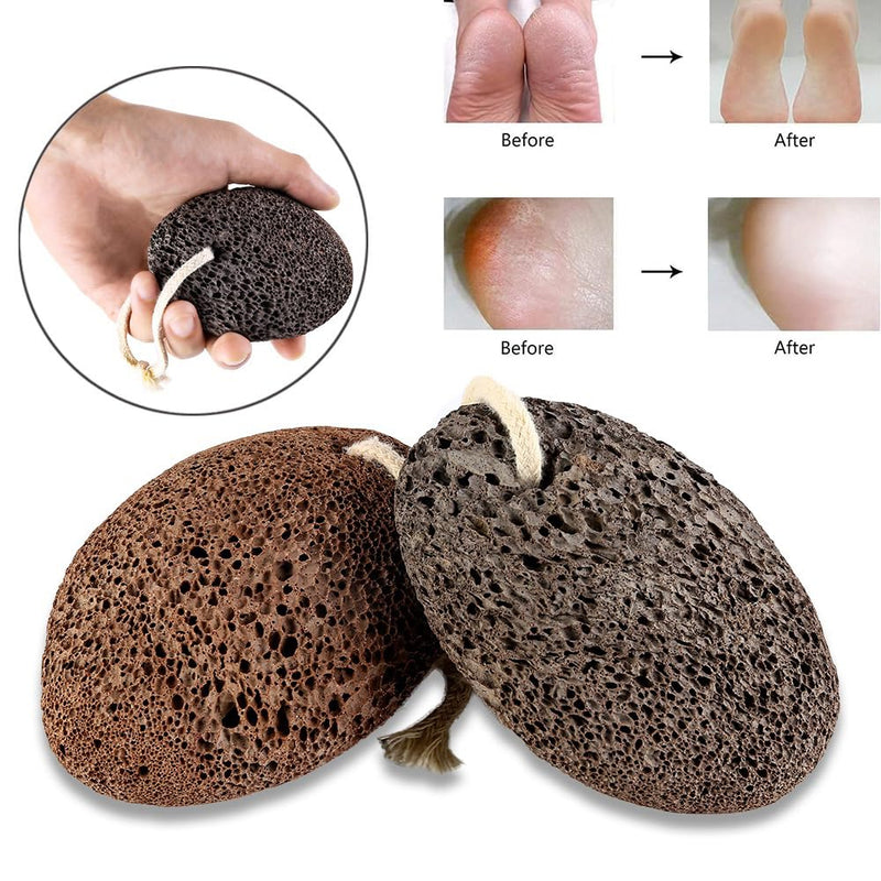 PHOGARY Natural Pumice Stone for Feet, 1 Pack Volcanic Lava Foot Stone Pedicure Tools Hard Skin Callus Remover for Feet and Hands - Natural Foot File Exfoliation to Remove Dead Skin-Black Foot Pumice Rock Black - BeesActive Australia