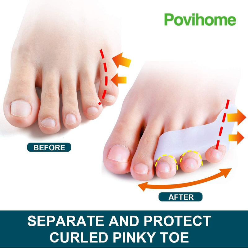 Povihome 10 Pack Pinky Toe Separator and Protectors, Triple Gel Toe Separators for Overlapping Toe, Curled Pinky Toes Separate and Protect - BeesActive Australia