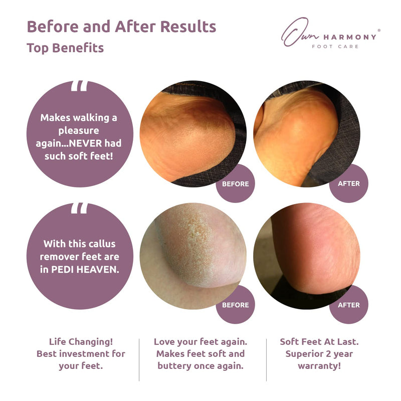 Electric Hard Skin Remover Rechargeable: Own Harmony Professional Pedicure Tools - CR1700 Best Electronic Foot File Sander - Perfect Pedi for Callus Removal and Dry Cracked Heels Feet Care (USB Cord) Satin Rose - BeesActive Australia