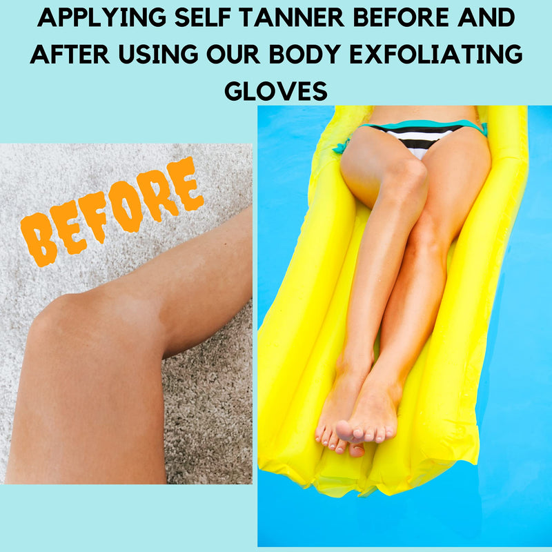 SMITCO Dead Skin Remover for Body - Exfoliating Gloves and Back Exfoliator for Men and Women - Full Body Scrubbers for Use in Shower or Bath to Improve Skin Texture and Get Rid of Bumpy Skin - BeesActive Australia