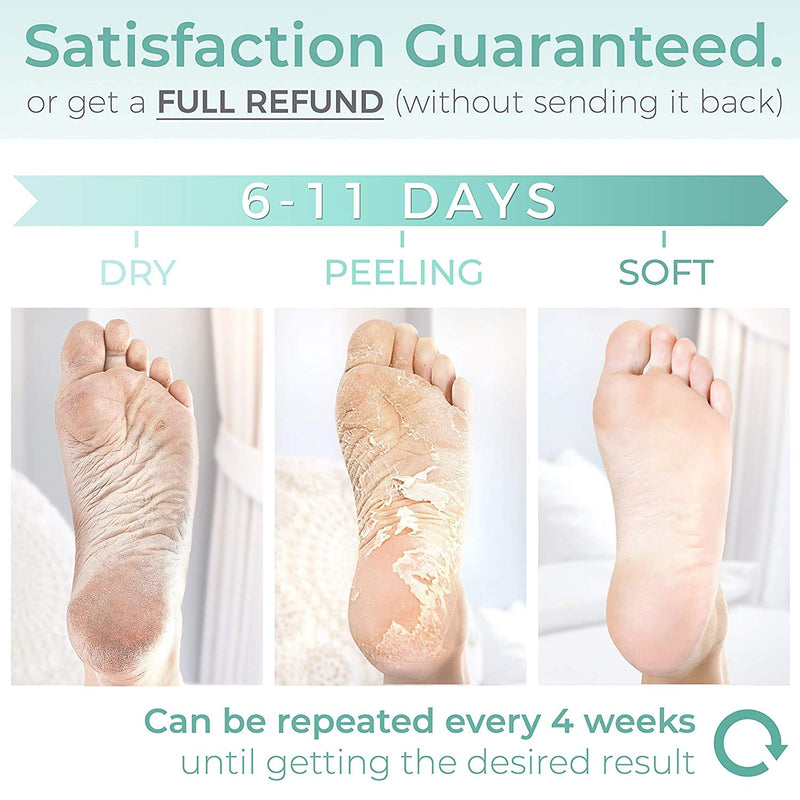 Foot Peel Mask - 2 Pack - For Cracked Heels, Dead Skin and Calluses - Make Your Feet Baby Soft Smooth Silky Skin - Removes Rough Heels, Dry Toe Skin Natural Treatment. (Rose Scent) - BeesActive Australia
