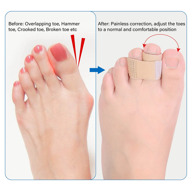 DYKOOK Broken Toe Wraps Toe Traps 8 Pcs/Pack Fabric Toe Splint Toe Cushioned Bandages Finger Protectors Straightener Separators - BeesActive Australia
