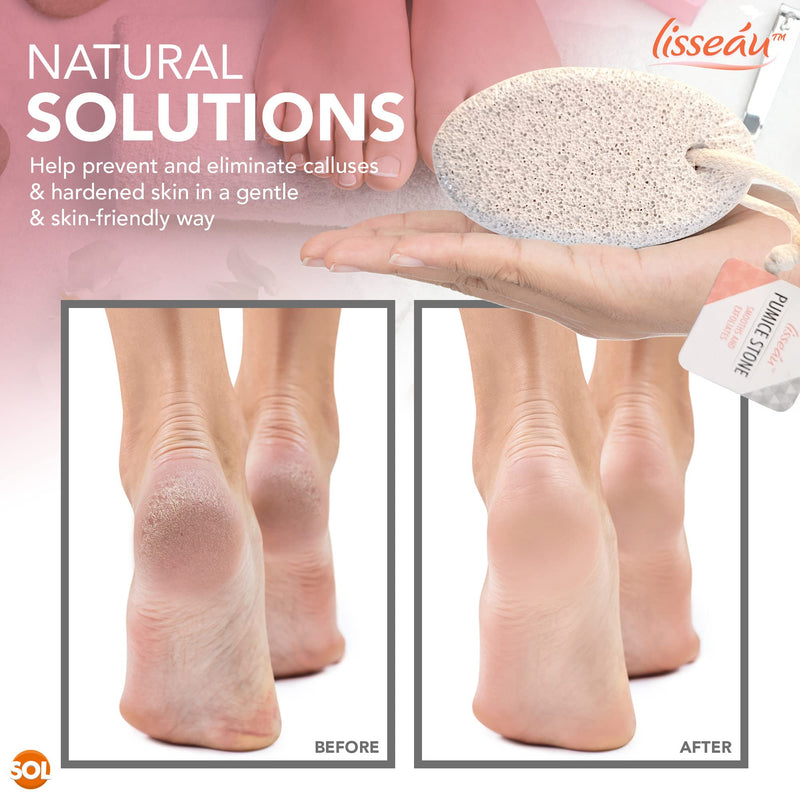 2pk Natural Pumice Stone for Feet | Callus Remover Feet Scrubber Dead Skin Pumice Stones | Foot Scrubber Pumice Stone Feet | Foot Pumice Stone for Hands Foot Stone Pumice for Hard Skin + SOL Notebook - BeesActive Australia