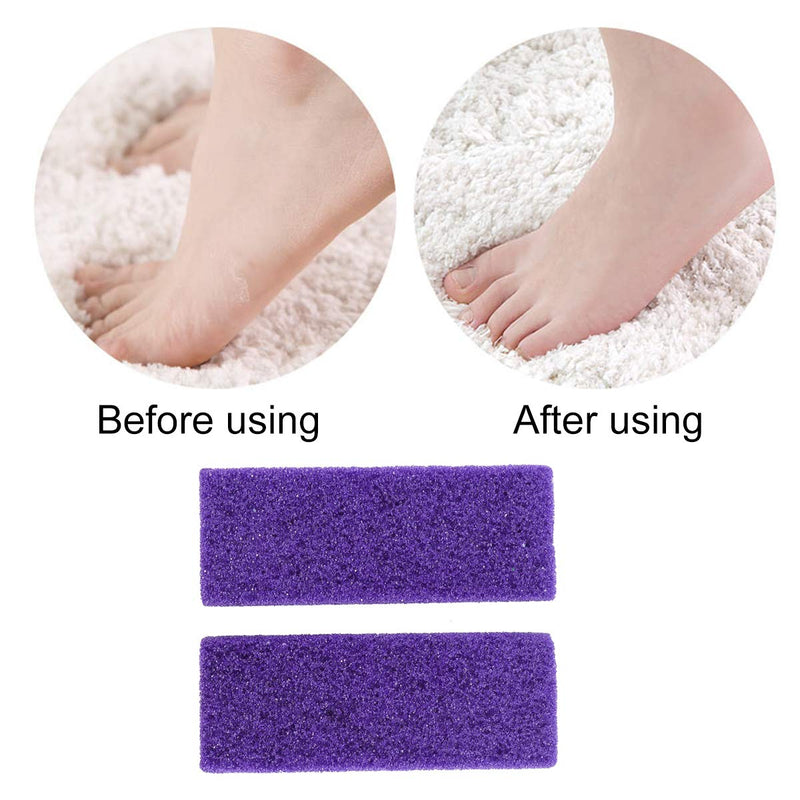 Healifty Foot Exfoliator Pedicure Tool Foot Callus Remover Scrubber 2pcs(Purple) - BeesActive Australia