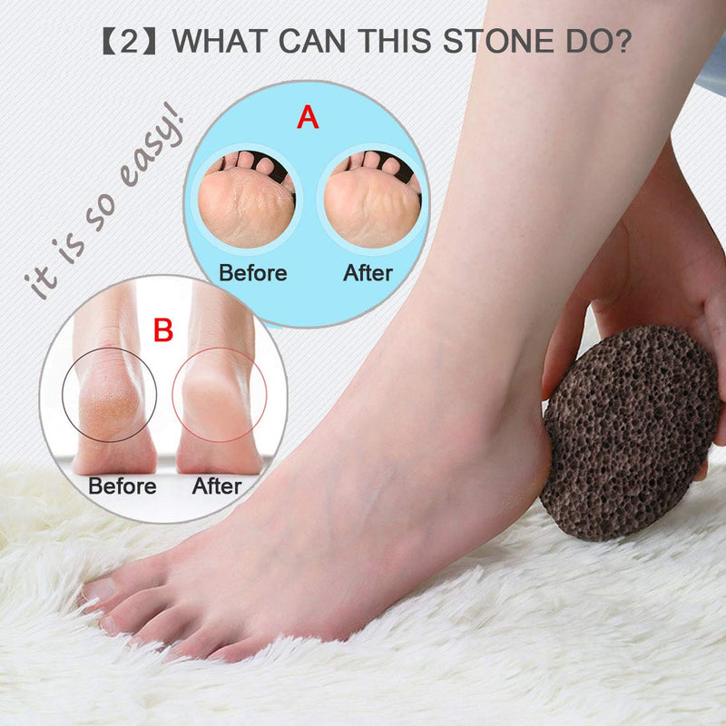 Natural Volcanic Lava Pumice Stone Foot and Hand Skin Pedicure Callus Dead Skin Remover(Brown) - BeesActive Australia