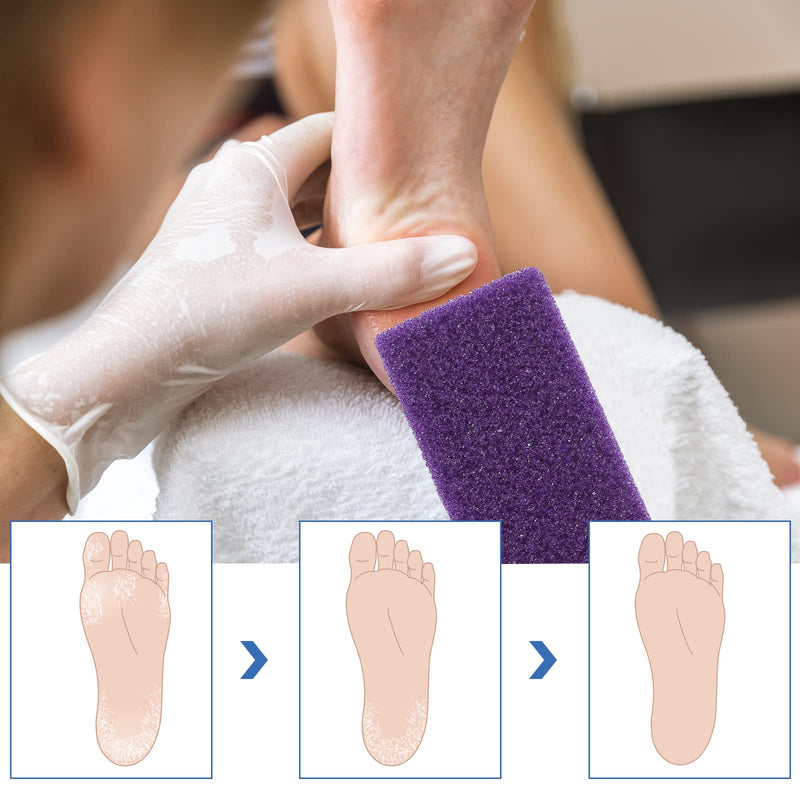 Healifty 6pcs Pumice Stone Feet Hard Skin Callus Remover Scrubber Pedicure Exfoliator Block Foot Care Tool Kit (Purple) - BeesActive Australia