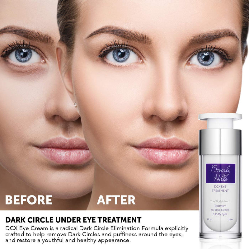 Beverly Hills DCX Eye Cream for Dark Circles, Puffy Eyes, Wrinkles and Crows Feet - BeesActive Australia