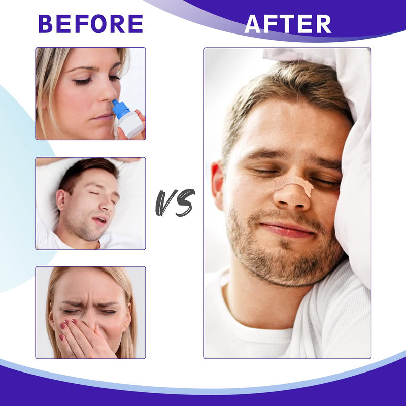 Nasal Strips, 120 Pieces Drug-Free Nose Strips to Stop Snoring and Relieve Nasal Congestion Improves Sleep Nasal Strips Snoring Anti Snore Strips - BeesActive Australia