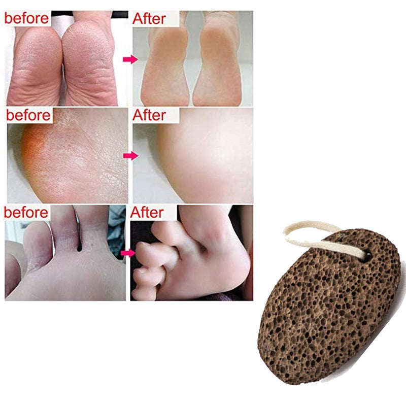 Premium Exfoliating Pumice Stone - Natural Foot Care & Pedicure Scrub Tool - Practical Dead Skin & Hard Callus Remover - Perfect For Healthy, Beautiful & Smooth Skin - BeesActive Australia