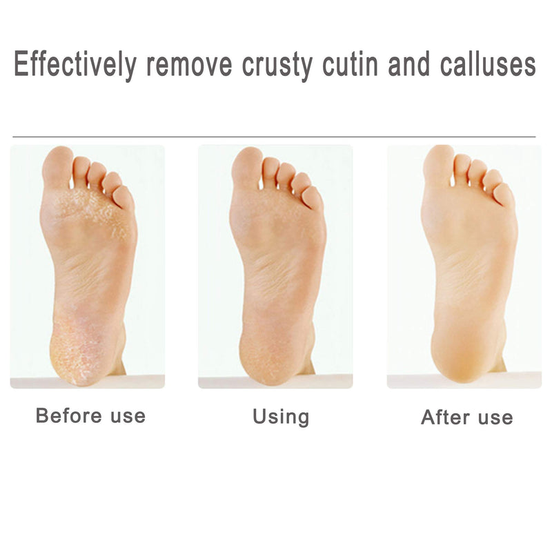 Professional Pedicure Foot File, Surgical Stainless Steel File, Exfoliating, Removing Calluses and Dead Skin, Can Be Used For Dry and Wet Feet - BeesActive Australia