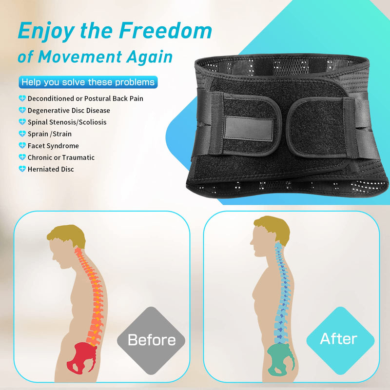 Back Brace for Men Lower Back - 2023 Lumbar Support Back Support Belt for Men and Women Lower Back Pain Relief, Herniated Disc, Sciatica, Scoliosis, Max Support with Steel Stays for Heavy Lifting M(33.5"-43") - BeesActive Australia