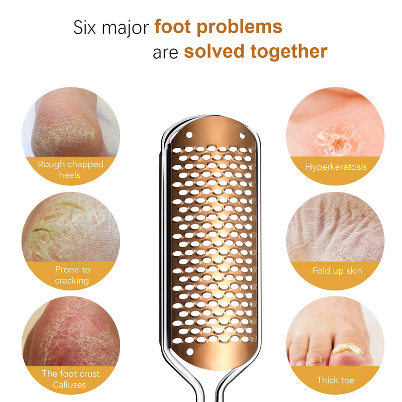 Pedicure Foot File Callus Remover - Large Foot Rasp Colossal Foot Scrubber Professional Stainless Steel Callus File for Wet and Dry Feet (Athens Copper) Athens Copper - BeesActive Australia