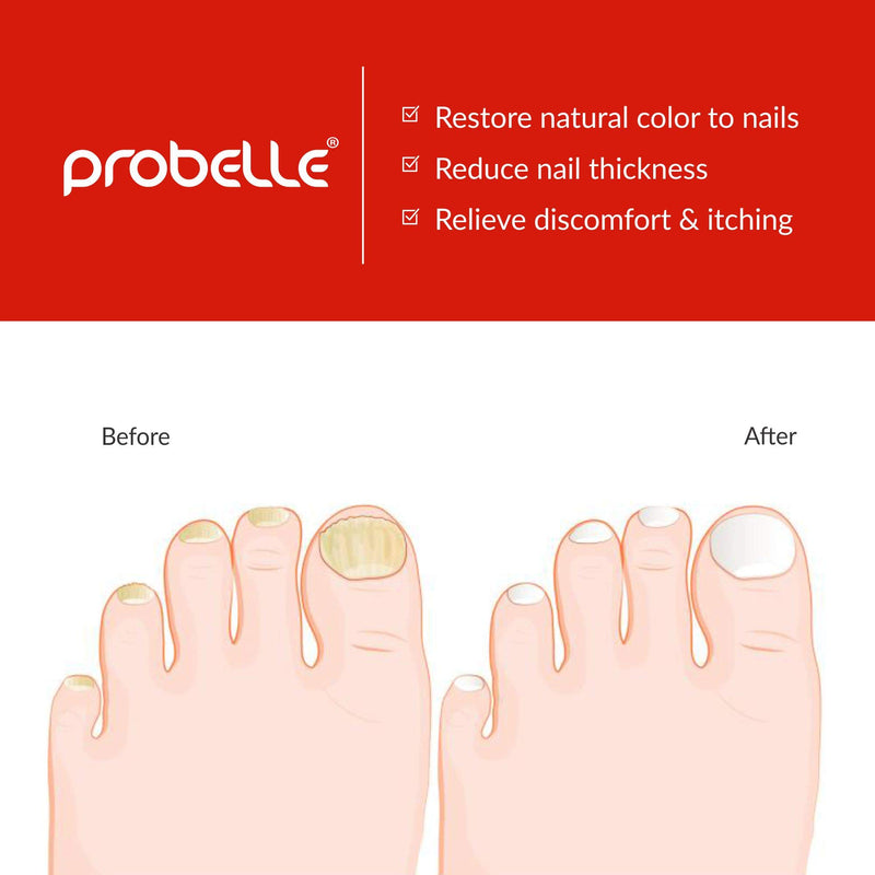 Probelle Natural Fungal Nail Treatment, Anti Fungal Nail Treatment, Nail Color Restoration, Clear Homeopathic Topical Solution .5 oz/ 15 ml (Patented Formula) - BeesActive Australia