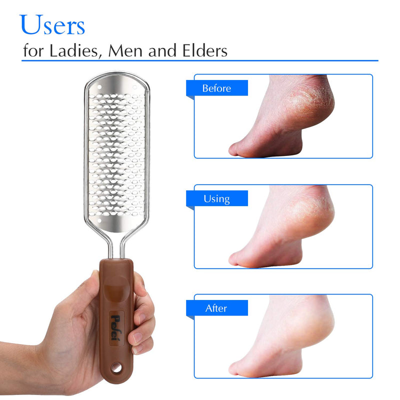 Professional Pedicure Foot File, Colossal Stainless Steel Detachable Foot Scrubber, Hard Skin Removers Pedicure Rasp for Wet and Dry Feet - BeesActive Australia