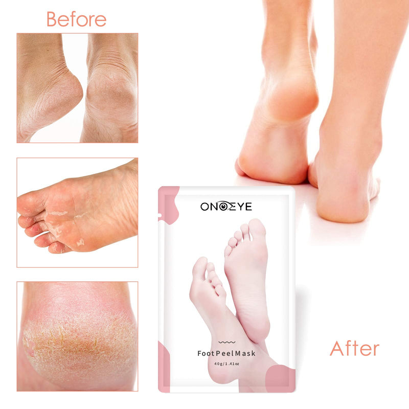 Foot Peel Mask 2 Pack, ONOEYE Exfoliating Foot Mask for Dead Skin Callus Remover and Repairs Rough Heels, Natural Foot Exfoliator Care Make Your Feet Baby Soft and Get a Smooth Skin for Men Women - BeesActive Australia