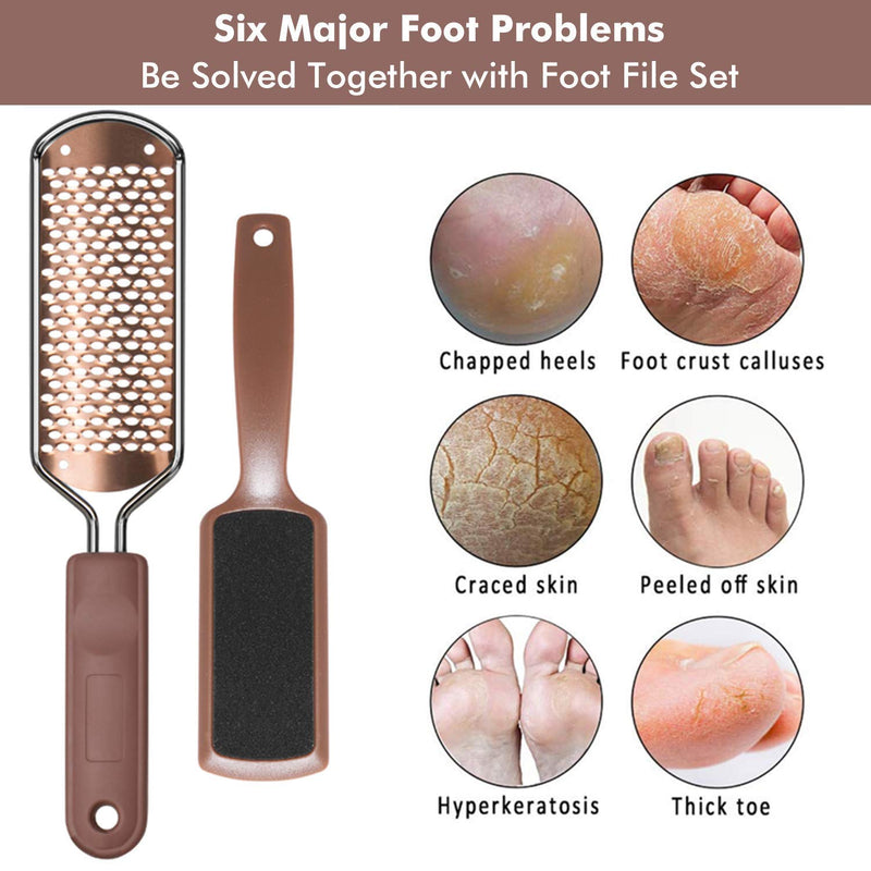 Foot Scraper, Heel Scraper for Feet - 3Pcs Pedicure Foot File Callus Remover, Foot Rasp Colossal Foot Scrubber for Dead Skin, Professional Stainless Steel Callus File for Wet and Dry Feet 1-Gold - BeesActive Australia