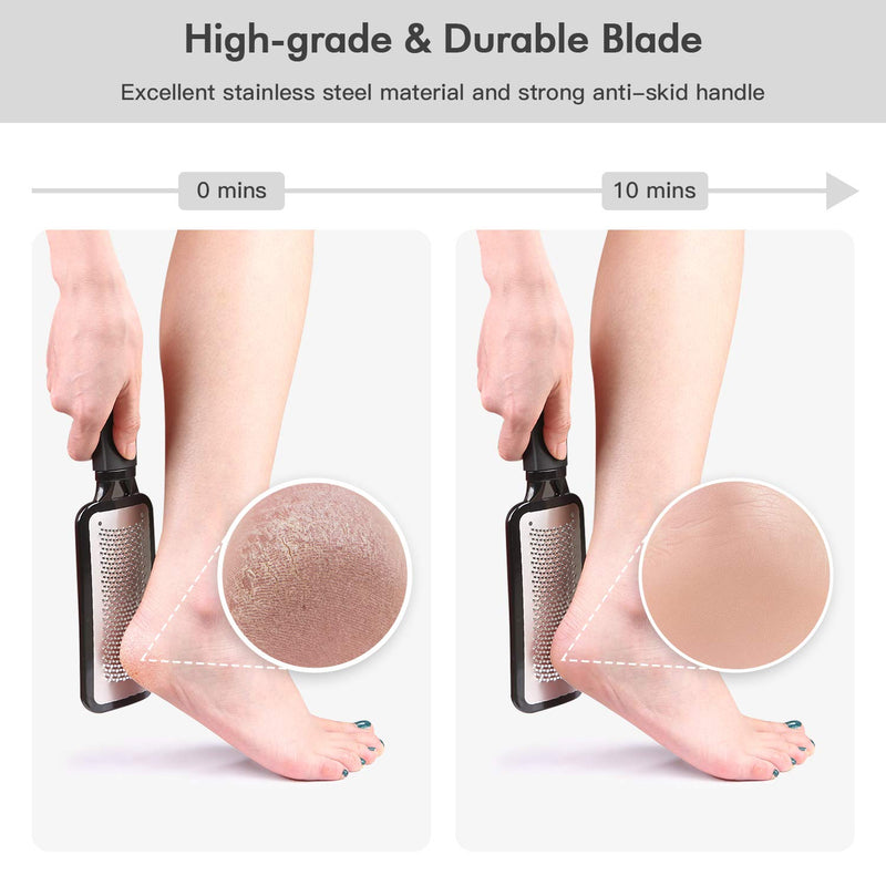 【Factory Direct】 Colossal Foot Rasp Foot Scrubber And Callus Remover，Surgical Grade Stainless Steel Foot File,Can Be Used On Trimming Dead Skin, Callus ect. Black - BeesActive Australia