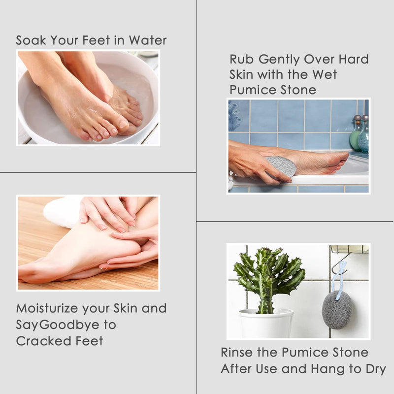 Pumice Stone 2 Pcs - Foot Pumice Stone for Feet Hard Skin Remover, Foot Scrubber Stone for Dead Skin, Calluses and Corns - BeesActive Australia