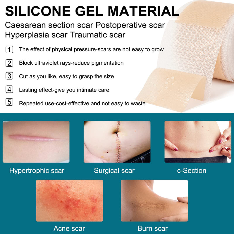 Silicone Scar Sheets (1.6” X 125”), Silicone Scar Tape Roll, Medical Grade Scar Removal Sheets for Keloid Scar Treatment, Old Scars, C-Section, Tummy Tuck, Reusable & Strong Adhesion, Waterproof One Size - BeesActive Australia
