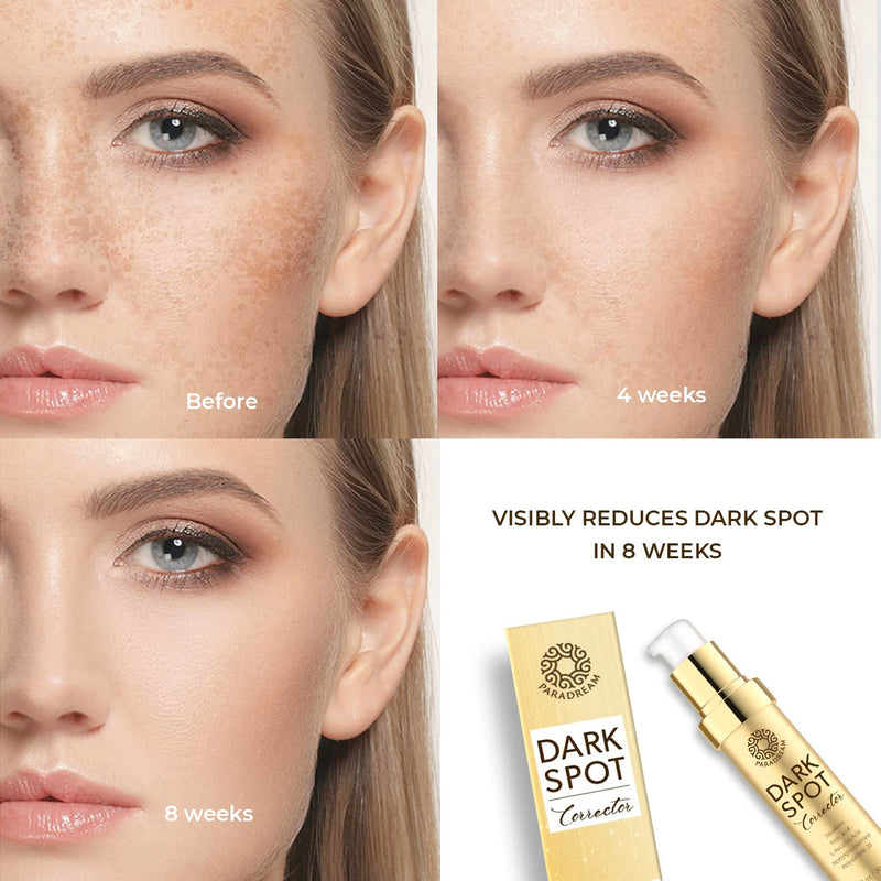 PARADREAM Dark Spot Remover for Face and Body, Dark Spot Corrector Serum - Advanced Melasma Hyperpigmentation Treatment, Sun Spot, Age Spot, Brown Spot Remover for Men and Women(1 FL OZ) - BeesActive Australia