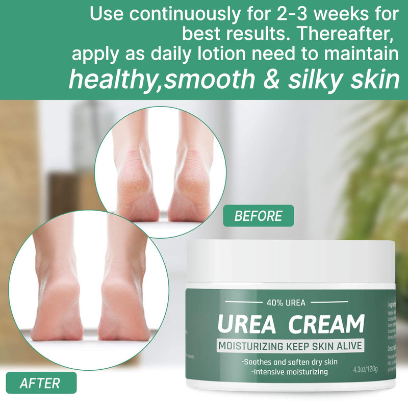 Urea Cream 40 Percent for Feet - Foot Cream for Dry Cracked Feet, Cracked Heel Repair, Elbows, Feet, Nails Edge, Hands, Exfoliates Dead Skin and Callus, Intensive Moisturizes & Softens Skin - BeesActive Australia