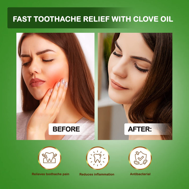NPOW Clove Oil, Clove Essential Oil, Clove Oil for Toothache Pain Relief, Clove Oil for Hair Growth, Oil of Cloves for Toothache, Essential Oil for Oral Discomfort - 30ml 30 ml (Pack of 1) - BeesActive Australia