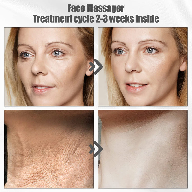 Aikertec Neck Face Massager, Electric Face and Neck Lifting Face Contouring Tool With 3 Colors of LED, Heating and Vibrating Skin Rejuvenating Beauty Device to Lift and Tighten Sagging Skin White - BeesActive Australia