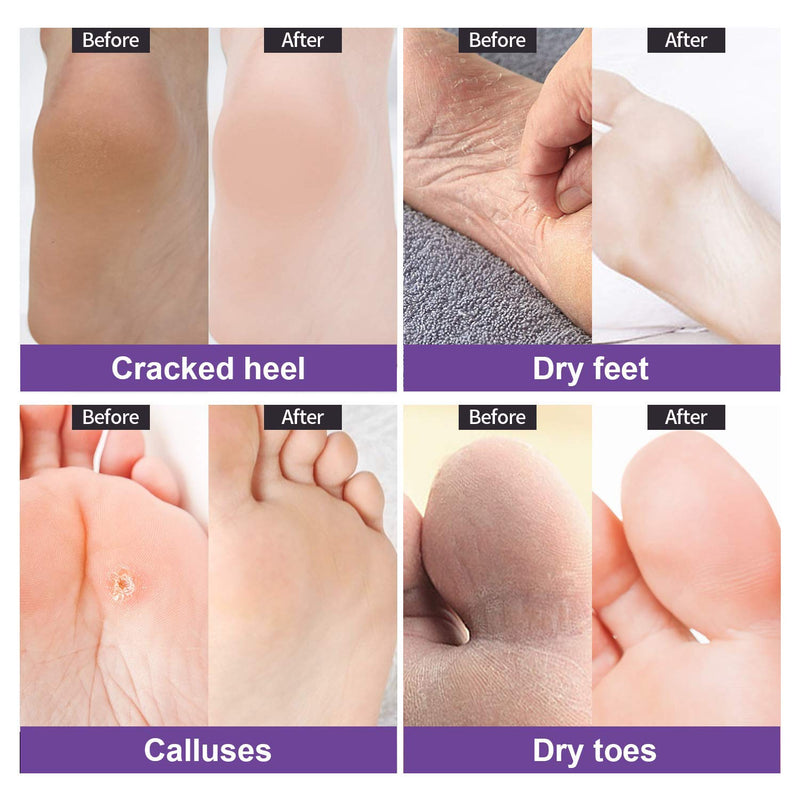 4-Pair Foot Masks, JC Gens Feet Peel Mask for Dry & Dead Skin, Exfoliating Booties Calluses Remover for Women, Men, Soft Baby Skin, Repair Tough Heels ( Lavender Scent ) - BeesActive Australia