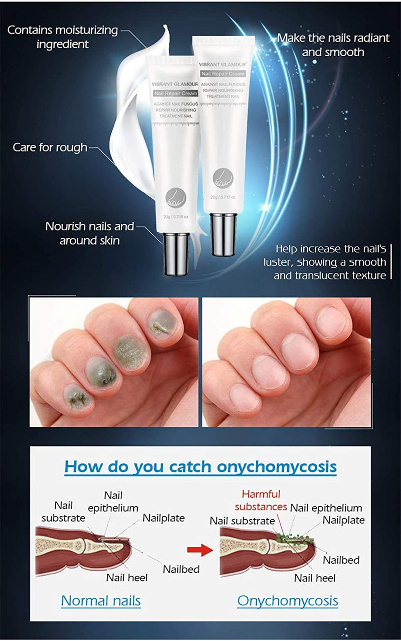 2pcs Vibrant Glamour Nail Care Nail Repair Cream Nail Fungus Treatment Onychomycosis Nail CareNail Repair Cream Nail Moisturizing, Restore Beautiful Nails - BeesActive Australia