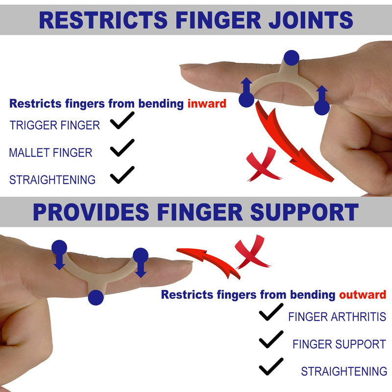10Pcs Oval Finger Splints & Sleeves Kit, 6 Graduated Oval Trigger Finger Splint & 4 Finger Sleeves for Trigger/Mallet/Arthritis/Straightening, Finger Brace Support for Thumb/Middle/Ring/Index/Pinky(Size 4,5,6,7,8,9) - BeesActive Australia
