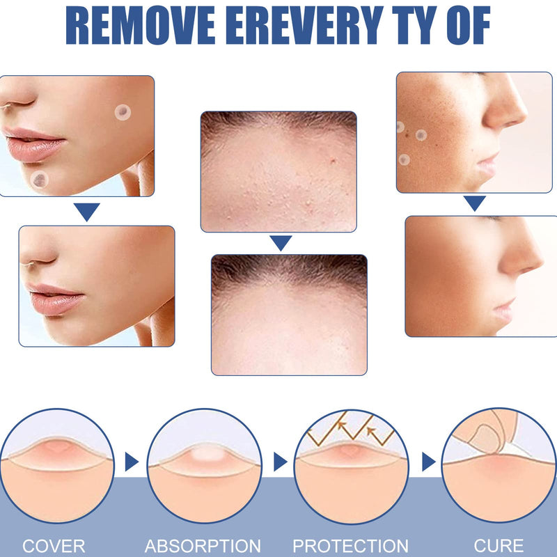 Mole Remover Patches,Skin Tag Removal Patches,Wart Healing Patches,Safe and Easy to Use in Minutes,144Pcs - BeesActive Australia