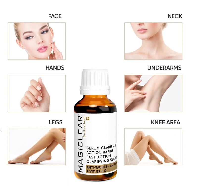 Luxury Swiss Dark Spot Remover for Face Body Serum Hyperpigmentation Treatment Age Sun Melasma Brown Spot Corrector Anti aging Bleaching Skin Lightening Vitamin C + Niacinamide organic Magiclear - BeesActive Australia