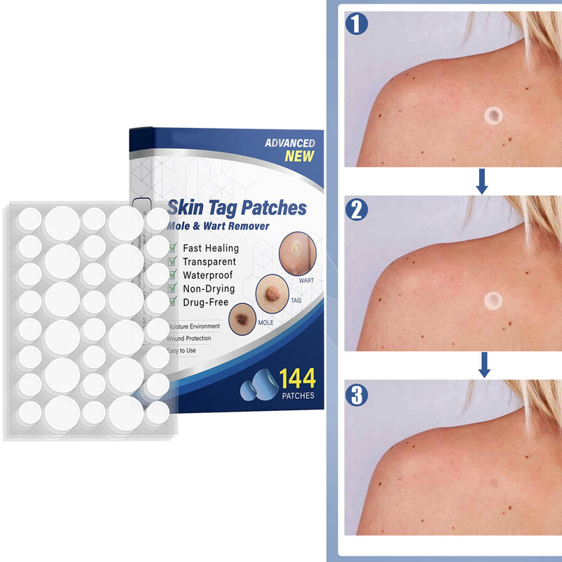 Mole Remover Patches,Skin Tag Removal Patches,Wart Healing Patches,Safe and Easy to Use in Minutes,144Pcs - BeesActive Australia