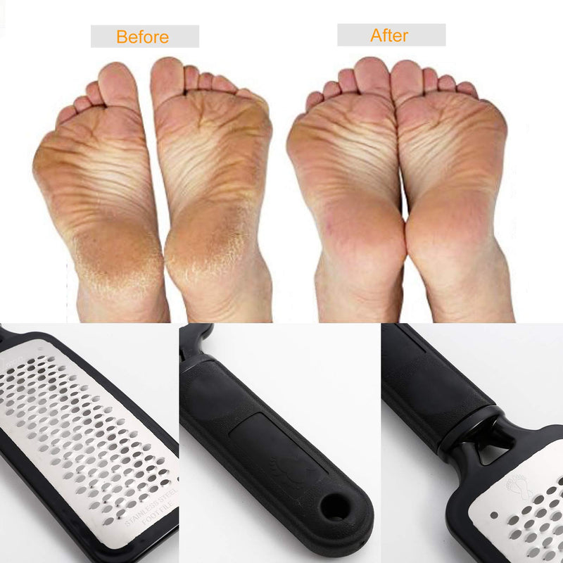 Foot File Callus Remover,Colossal Foot Rasp and Professional Foot Scrubber Pedicure Kit to Remove Hard Skin for Wet and Dry Feet,Surgical Grade Stainless Steel File (black and silvery) black and silvery - BeesActive Australia