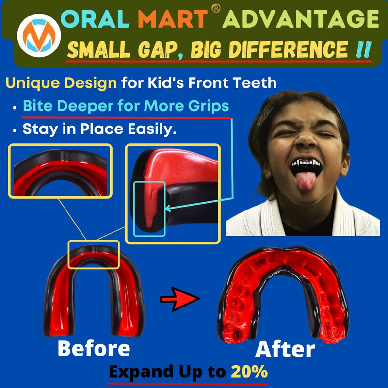 Oral Mart Sports Youth Mouth Guard for Kids (USA Flag & 3 Fangs & 15 Best Colors) | Youth Mouthguard (BPA Free) Football, MMA, Karate, Flag Football, Rugby, Boxing, BJJ, Hockey (/w Vented Case) (Youth, Strapless) Youth (Age 12 & Below) Black Fangs - BeesActive Australia